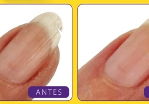 Antes e depois Nail Bond

Foto: Mohda Cosméticos