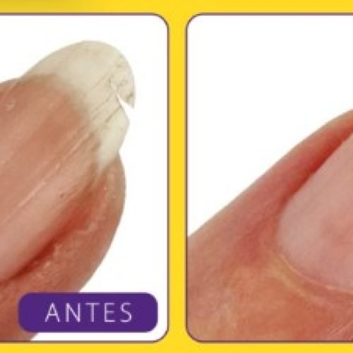 Antes e depois Nail Bond

Foto: Mohda Cosméticos