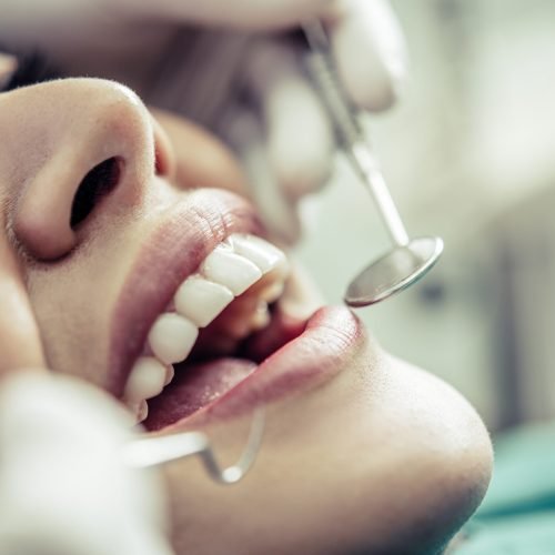 Alterações nos dentes e na gengiva podem sinalizar desequilíbrios no organismo e merecem atenção preventiva